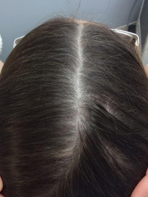 After — patient 1