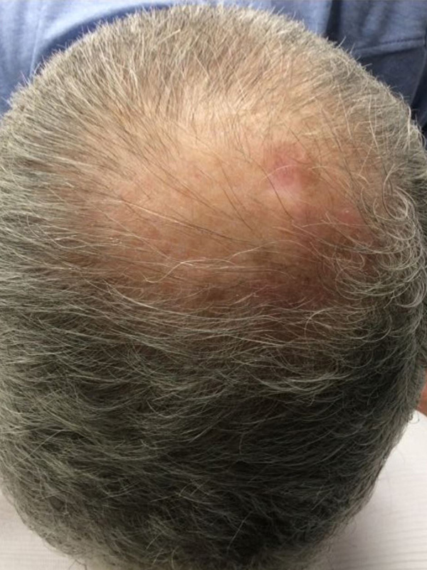 After — patient 2