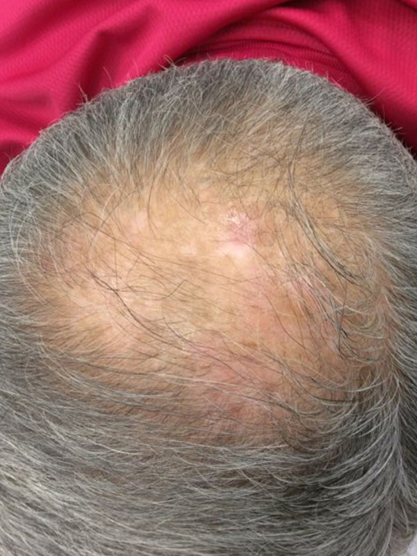 Before — patient 2
