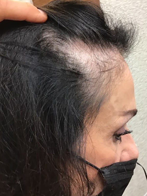 Before — patient 3