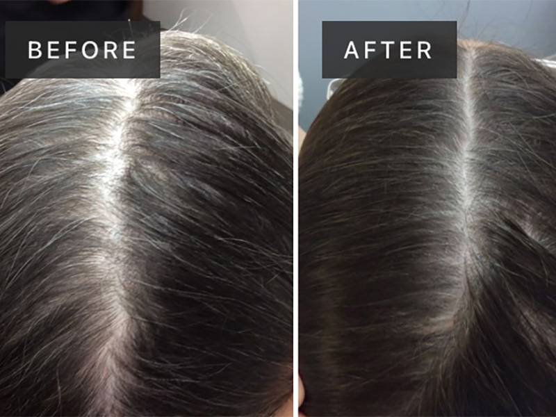 Card: Before / After