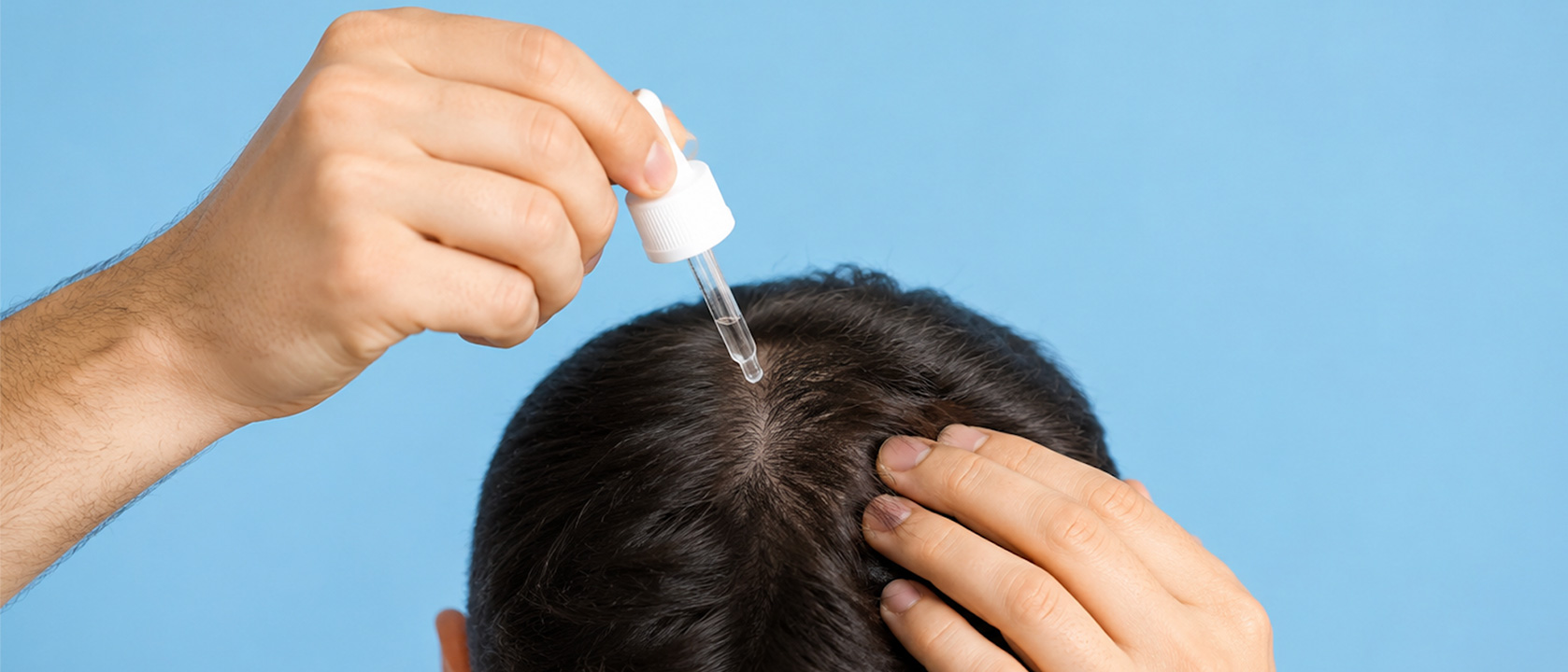 Minoxidil feature banner