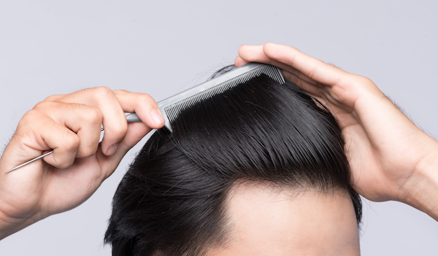 prp for hair loss